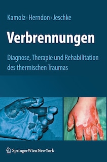 Front cover_Verbrennungen