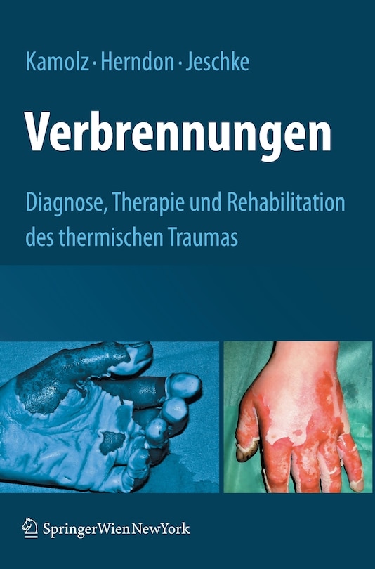 Front cover_Verbrennungen