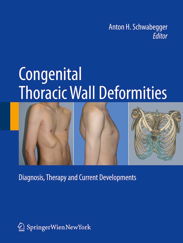Front cover_Congenital Thoracic Wall Deformities