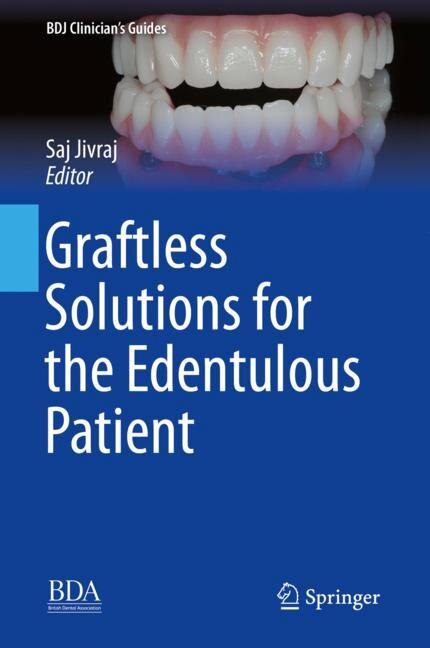 Front cover_Graftless Solutions For The Edentulous Patient