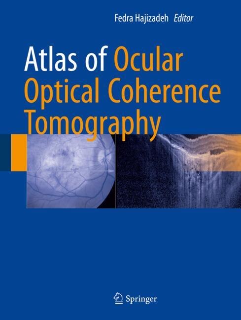 Couverture_Atlas Of Ocular Optical Coherence Tomography