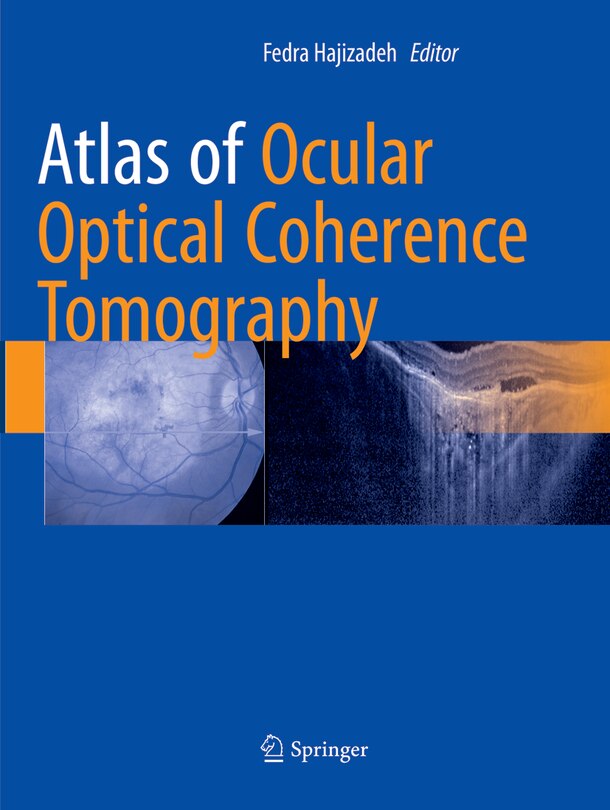 Front cover_Atlas Of Ocular Optical Coherence Tomography