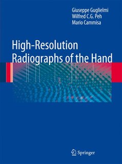 Front cover_High-Resolution Radiographs of the Hand