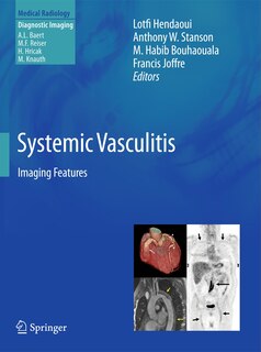 Couverture_Systemic Vasculitis