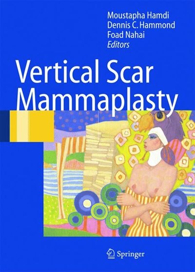 Couverture_Vertical Scar Mammaplasty