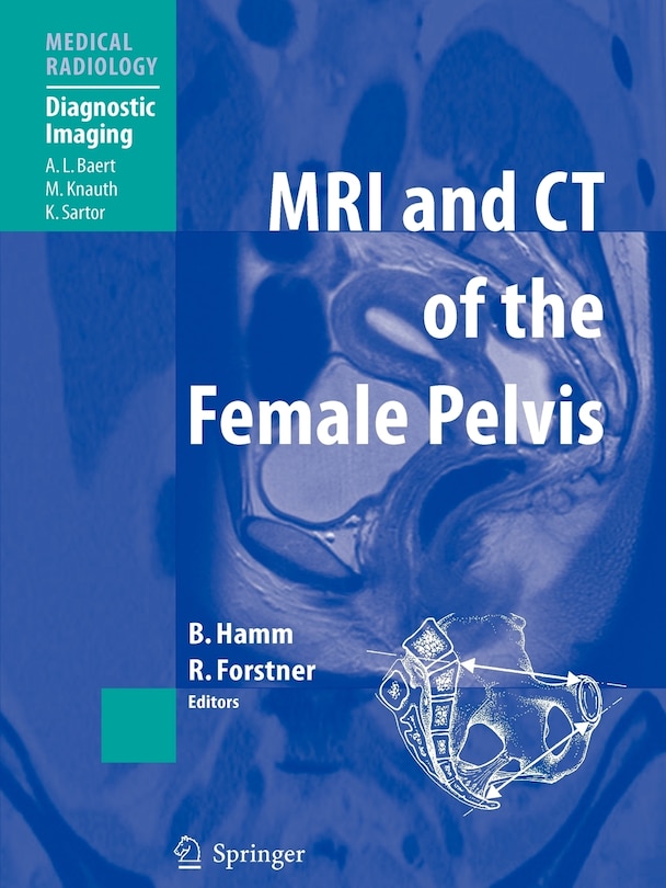 Couverture_MRI and CT of the Female Pelvis