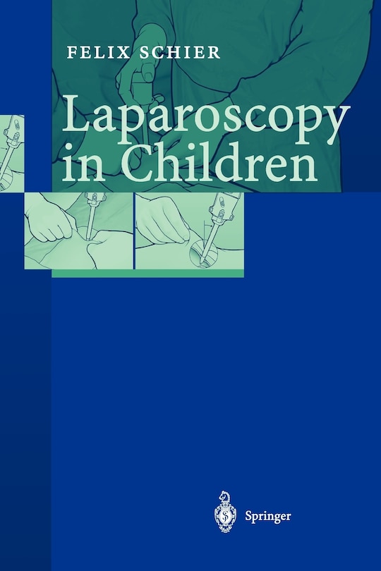 Couverture_Laparoscopy in Children