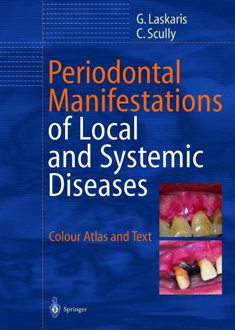 Front cover_Periodontal Manifestations of Local and Systemic Diseases