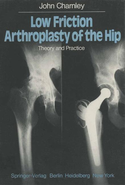 Front cover_Low Friction Arthroplasty of the Hip
