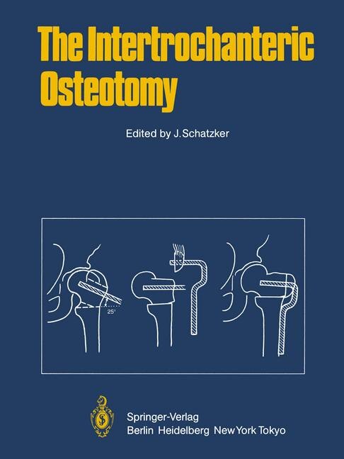 Couverture_The Intertrochanteric Osteotomy
