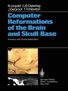 Front cover_Computer Reformations of the Brain and Skull Base