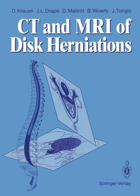Front cover_CT and MRI of Disk Herniations