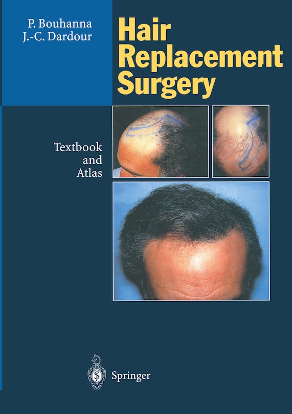 Front cover_Hair Replacement Surgery