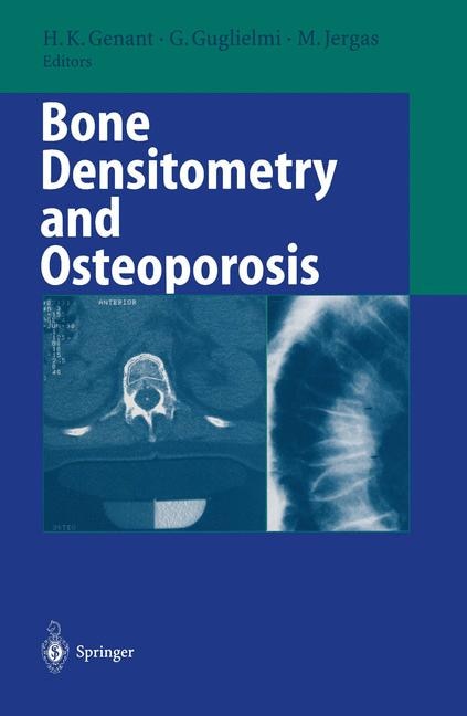 Couverture_Bone Densitometry and Osteoporosis