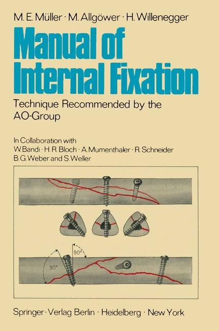 Front cover_Manual of Internal Fixation