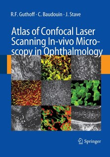 Front cover_Atlas Of Confocal Laser Scanning In-vivo Microscopy In Ophthalmology