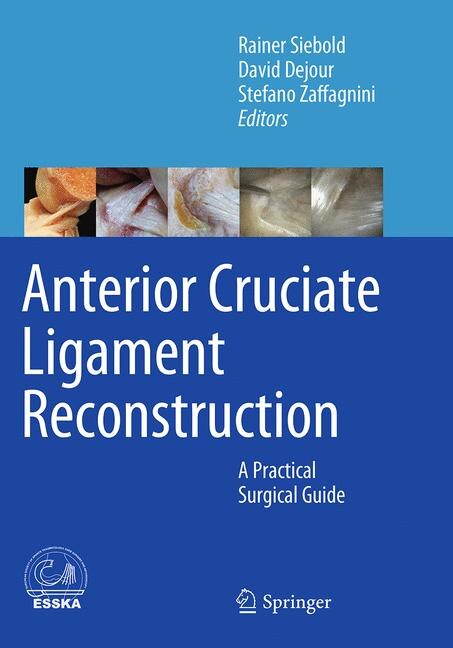 Front cover_Anterior Cruciate Ligament Reconstruction