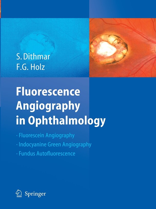 Front cover_Fluorescence Angiography In Ophthalmology