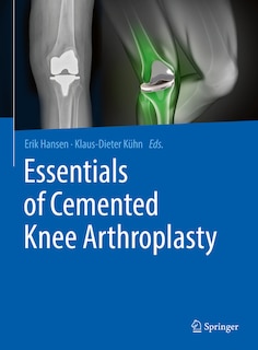 Couverture_Essentials Of Cemented Knee Arthroplasty