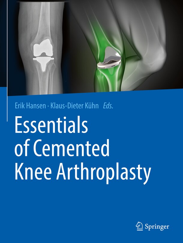 Couverture_Essentials of Cemented Knee Arthroplasty