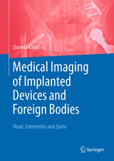 Front cover_Medical Imaging of Implanted Devices and Foreign Bodies