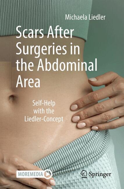 Front cover_Scars After Surgeries in the Abdominal Area