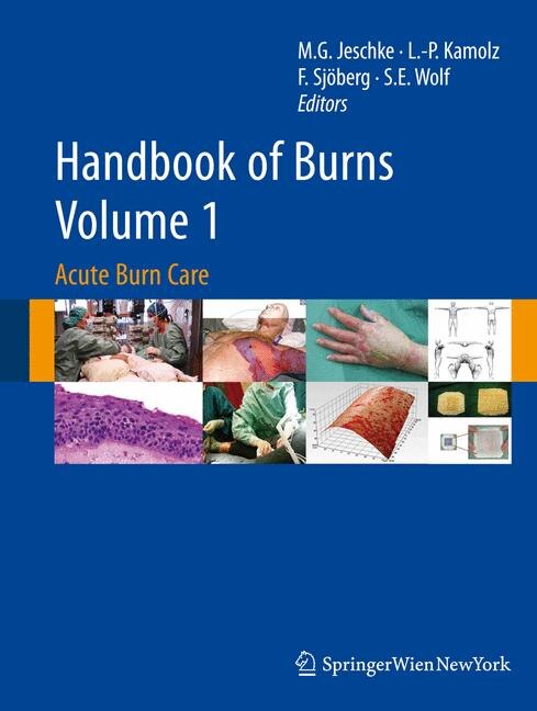 Front cover_Handbook of Burns Volume 1