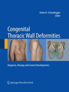 Front cover_Congenital Thoracic Wall Deformities