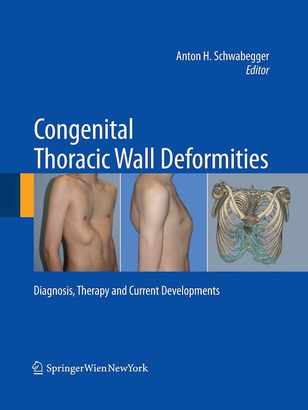 Front cover_Congenital Thoracic Wall Deformities