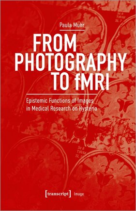 From Photography To Fmri: Epistemic Functions Of Images In Medical Research On Hysteria