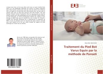 Couverture_Traitement du Pied Bot Varus equin par la methode de Ponseti