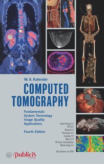 Computed Tomography: Fundamentals, System Technology, Image Quality, Applications