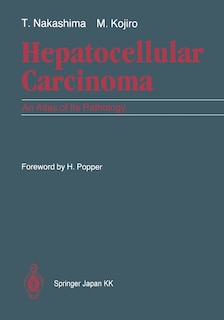 Hepatocellular Carcinoma: An Atlas of Its Pathology