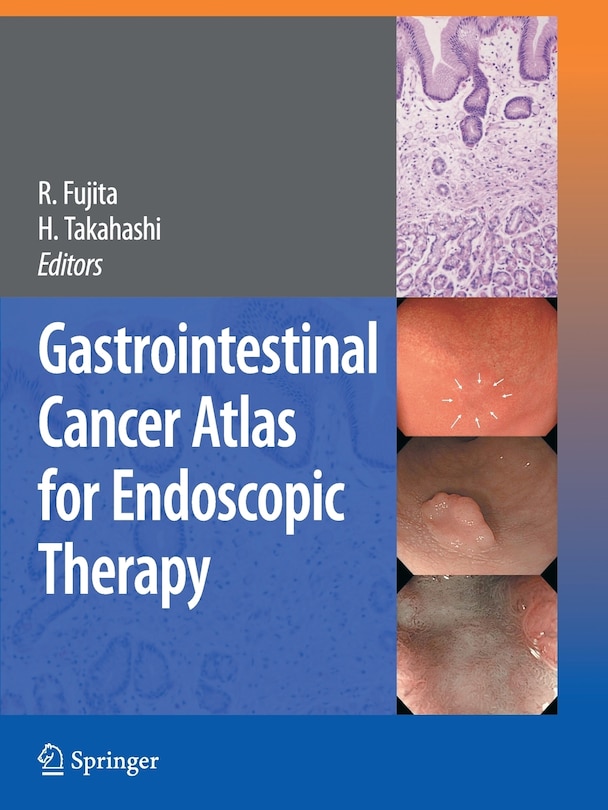Front cover_Gastrointestinal Cancer Atlas for Endoscopic Therapy