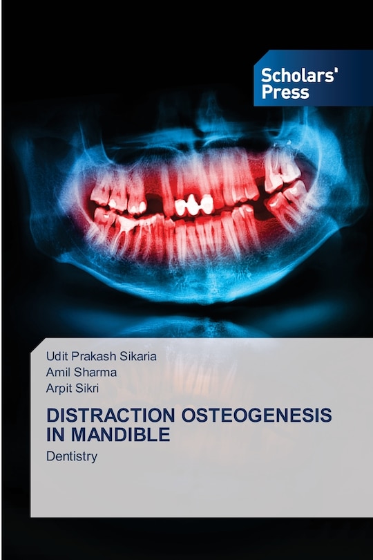 Front cover_Distraction Osteogenesis in Mandible