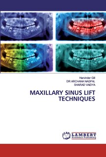 Front cover_Maxillary Sinus Lift Techniques