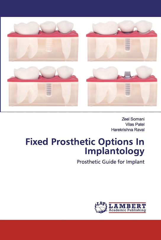 Front cover_Fixed Prosthetic Options In Implantology