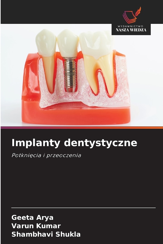 Couverture_Implanty dentystyczne