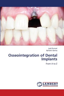 Front cover_Osseointegration of Dental Implants