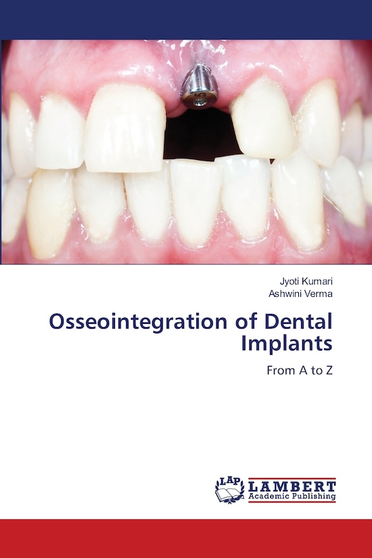 Front cover_Osseointegration of Dental Implants
