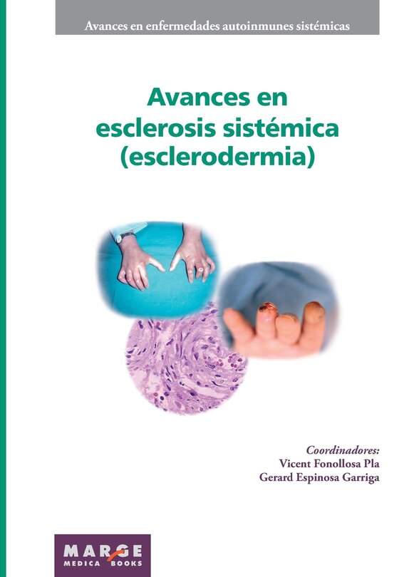 Front cover_Avances en esclerosis sistémica (esclerodermia)