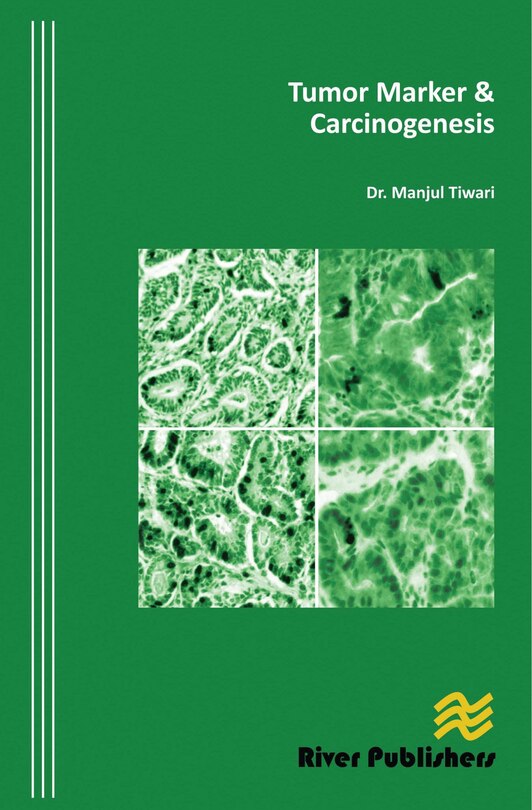 Front cover_Tumor Marker And Carcinogenesis