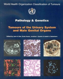 Pathology and Genetics of Tumours of the Urinary System and Male Genital Organs