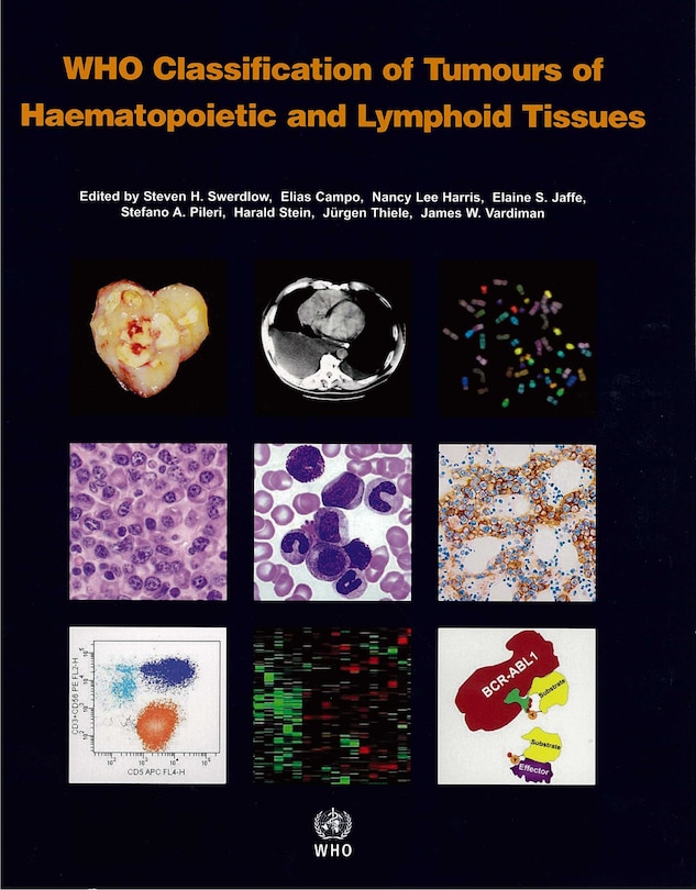 Couverture_Who Classification Of Tumours Of Haematopoietic And Lymphoid Tissue [op