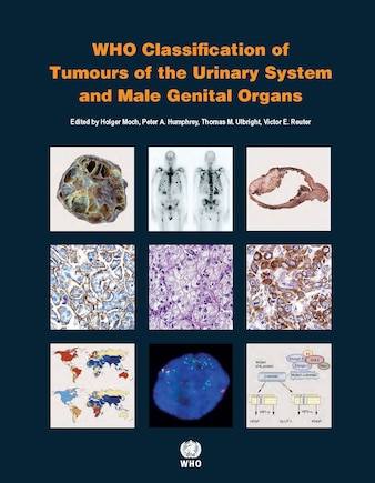 WHO Classification of Tumours of the Urinary System and Male Genital Organs [OP