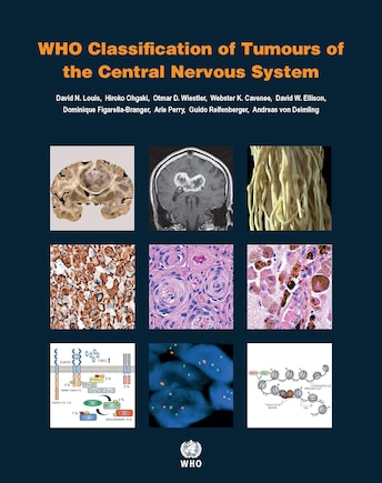 WHO Classification of Tumours of the Central Nervous System [OP