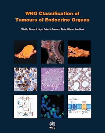 Who Classification Of Tumours Of Endocrine Organs