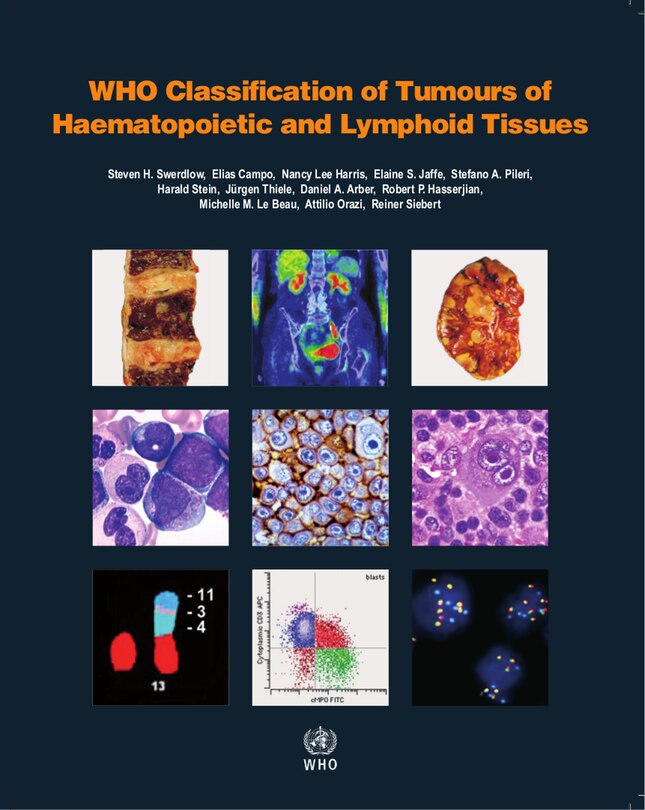 Front cover_WHO Classification of Tumours of Haematopoietic and Lymphoid Tissues [OP