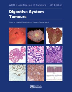 Couverture_Digestive System Tumours