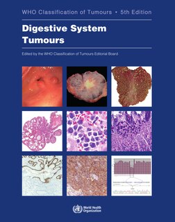 Digestive System Tumours: Who Classification Of Tumours